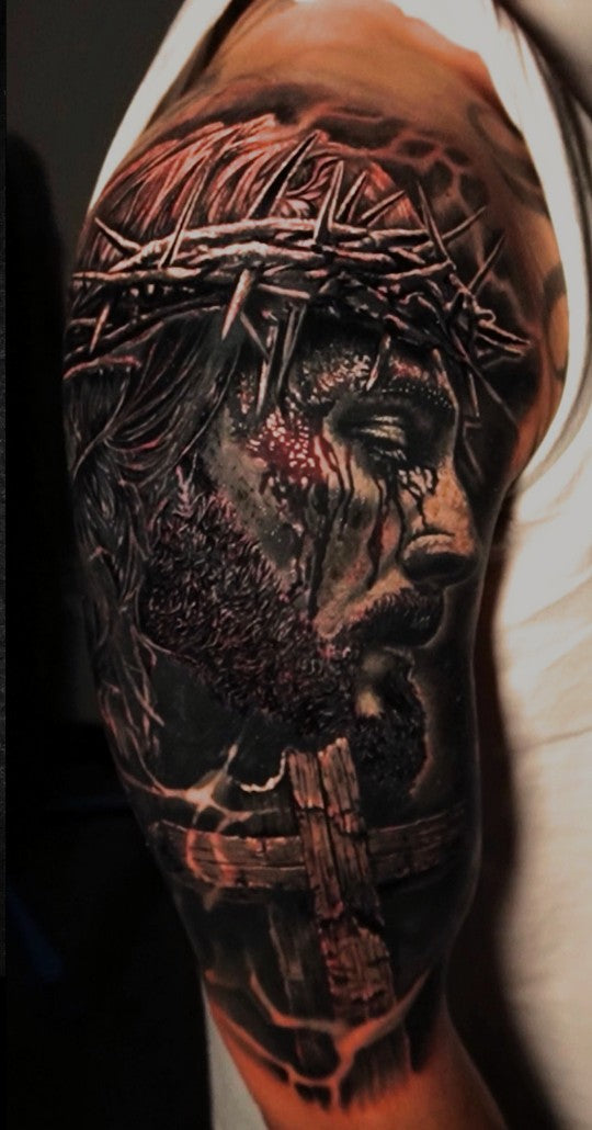 Crown of thorns cover-up, healed result